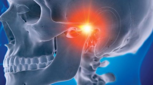 41406_2020_181_Fig1_HTML